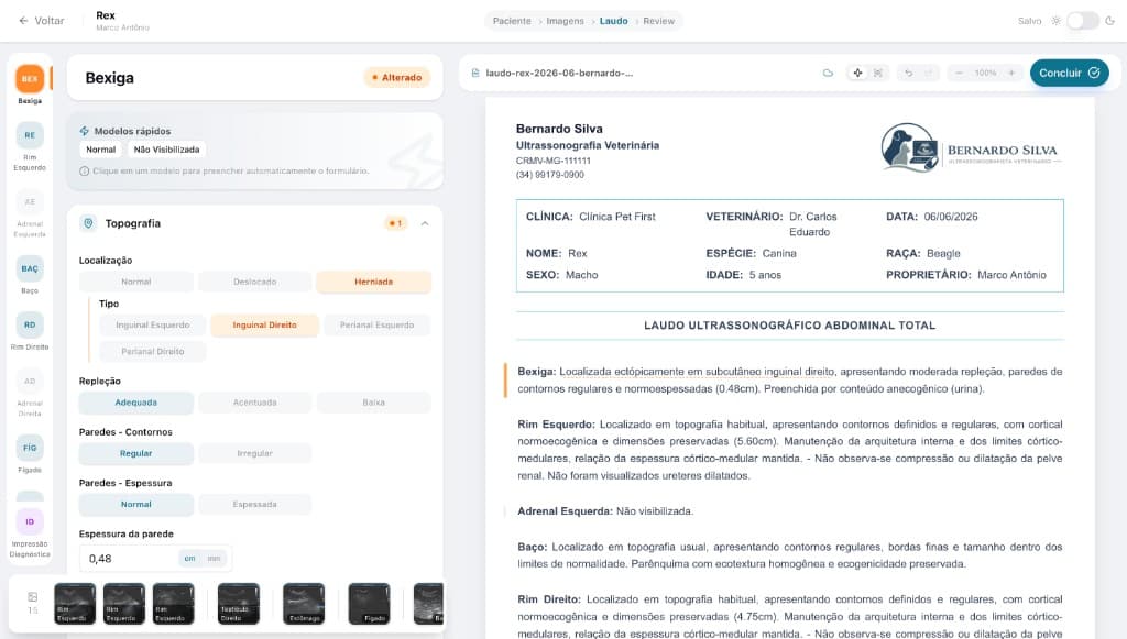 Editor de laudos de ultrassom com IA e preview do documento
